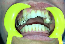 AF1QipPZPMGFwMm7mo-vGKZ9_-QIYXaUatwdnPSayh50w260-h175-n-k-no-5-1.jpg